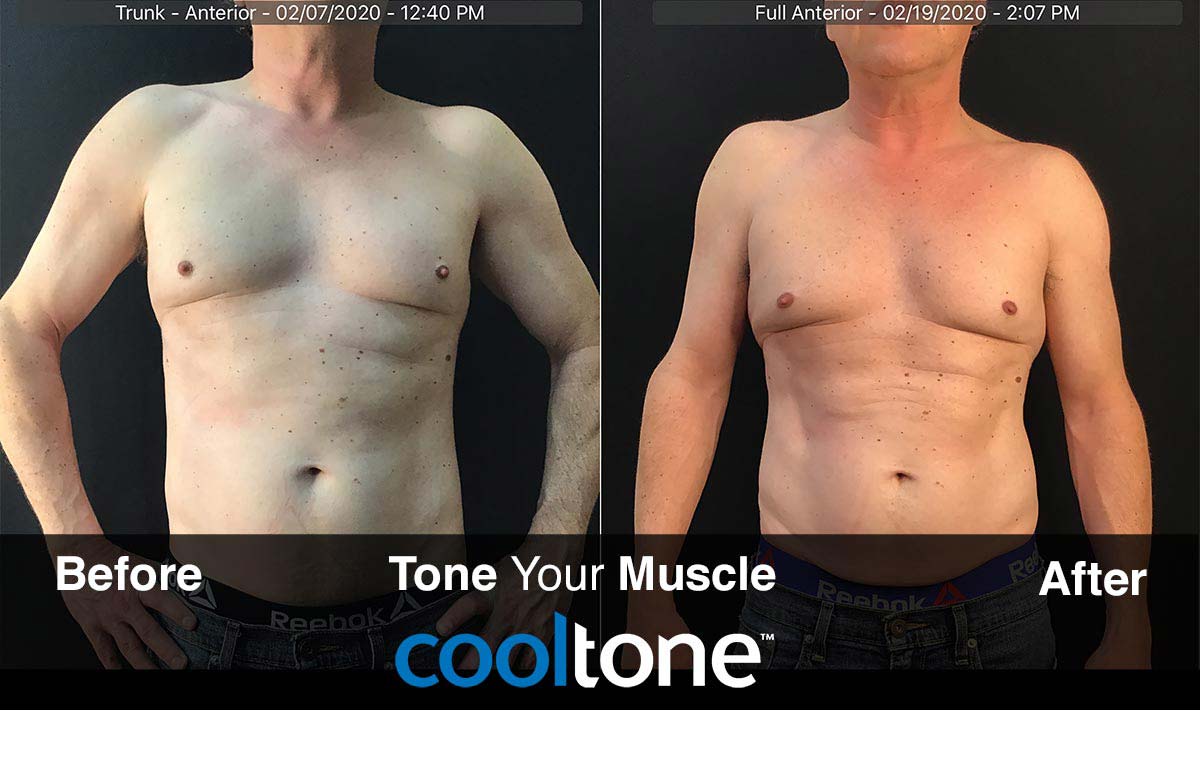 CoolTone - Tone Your Muscle